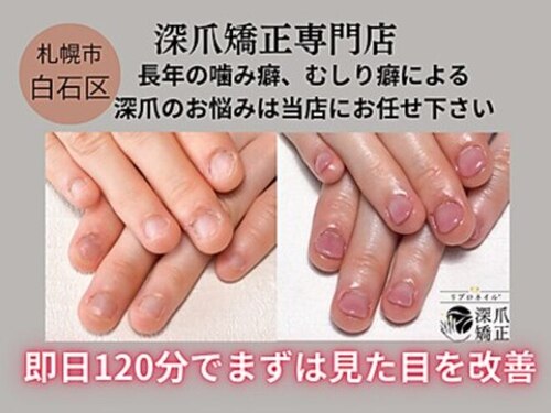 ポメロ(POMELO)(北海道札幌市白石区本郷通8南3-23エターナルF603)