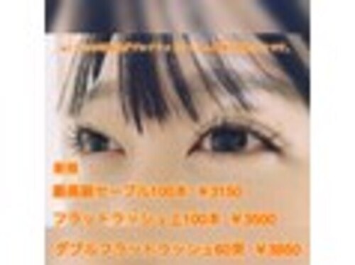 シャンシャン(schon schon)(北海道札幌市北区太平5条5-1-11コーポ庭山201)
