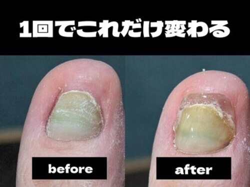 ネイルズ ヴォロンティエ(Nail's Volontiers)(北海道札幌市中央区大通西17-2ー14ハイツ大通303)