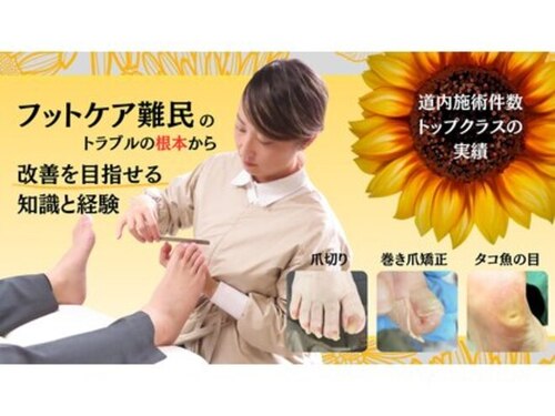 【巻き爪タコ魚の目ケア肥厚爪角質】フットケアステーションFreshFoot(北海道札幌市中央区南1条西22-2-23ケイキ円山302)