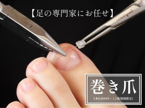 ドクターネイル爪革命札幌大通店【巻き爪肥厚爪魚の目タコフットケア専門店】(北海道札幌市中央区南5条西18- ※住所詳細は予約確定後にお伝えします。)