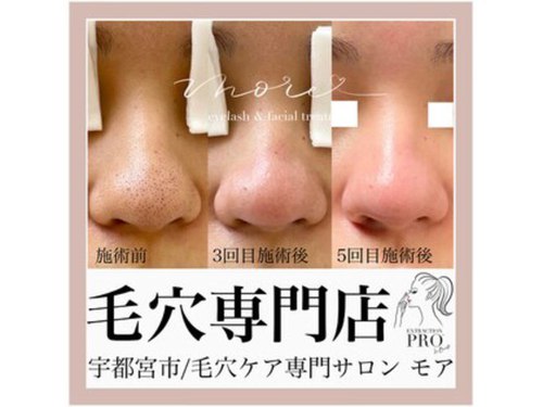 モア(MORE)(栃木県宇都宮市鶴田2―3―20 クレインズ桜 203)
