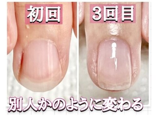 スターネイル(Starnail)(千葉県佐倉市王子台5-※詳細はご予約確定後にお伝えいたします※)