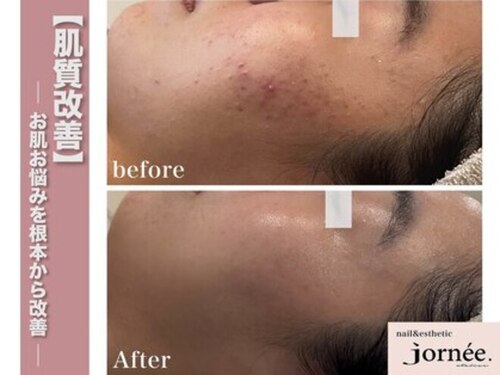 ジョルネ 中目黒(jornee.)(東京都目黒区中目黒1-※予約確定後に詳細住所をお送り致します)