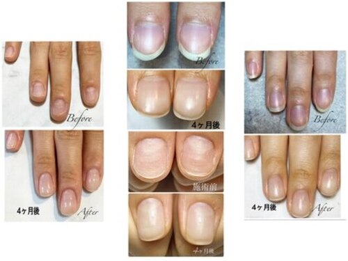 ミリアネイル 成城(Miliea nail)(東京都世田谷区成城5-14-14ローブクレール102)