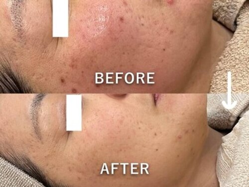 ミジョカフェイシャル(mijoka facial)(静岡県浜松市中央区神原町804-1)