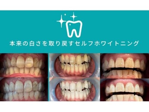 ルースネイル(Loose Nail)(愛知県稲沢市中之庄町高上1-22)