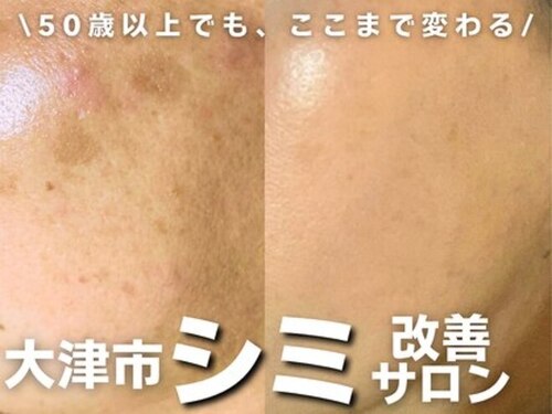 ビュキュア(滋賀県大津市中央3-2-3 ライオンズ旅行企画ビル2F)