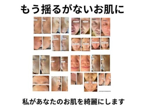 キュアラ(CUARA)(滋賀県米原市夫馬685-2)