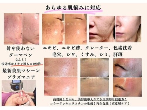 ビーナス(Venus)(大阪府高石市取石2-37-41-1F2F)