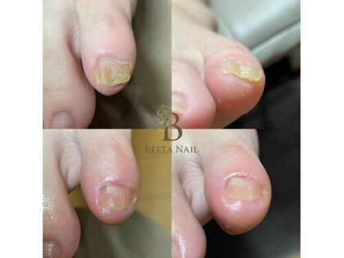 ベルタネイル(BELTA NAIL)(岡山県岡山市南区豊成3-21-7 ライズガーデン参番館203)