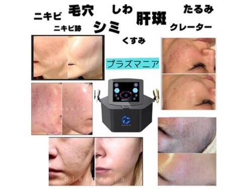 ビューティーネイル(Beauty Nail)(熊本県熊本市西区上代3-14-66)