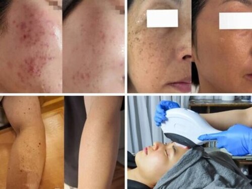 ハーブスキン(herb skin)(北海道札幌市東区北22条東13-2-12 105)