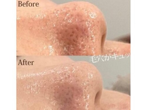 フォルチェ ゆめタウン広島店(Folche)(広島県広島市南区皆実町2-8-17 ゆめタウン広島3F)