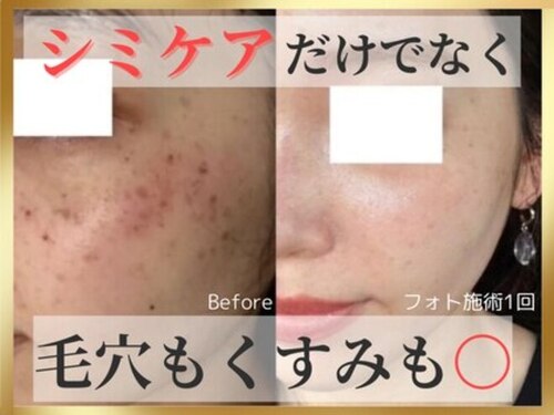 シャイン アイラッシュ(Shine Eyelash)(広島県広島市中区中町3-3 ジャルダン並木2F)