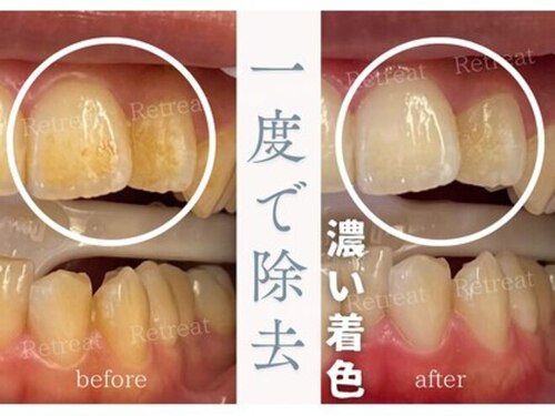 リトリート(Retreat)(広島県広島市中区紙屋町1-5-3 HIRANObldg 401)