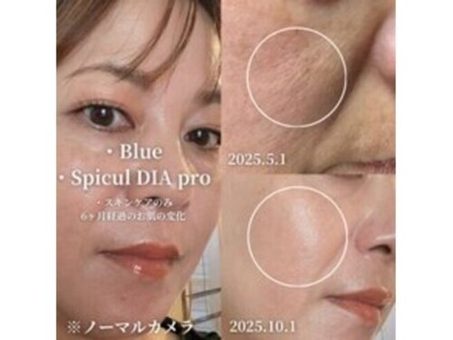 アンジー(an.g)(広島県福山市御幸町上岩成254-1)