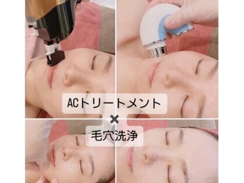 エステティックサロンさら(山口県宇部市中野開作414-3)