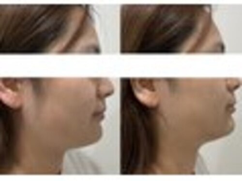 ラブリエ(La Briller)(徳島県阿南市富岡町東池田口6-2)