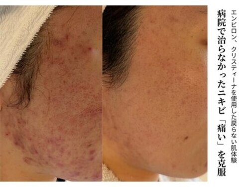 ハナコ 健軍店(HANAKO)(熊本県熊本市東区健軍3-39-14)