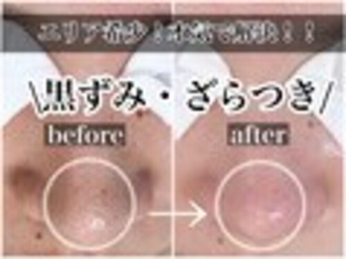 ニュートラル(neutral)(大分県大分市明野東1-2349番地明野ガーデンテラス2F)